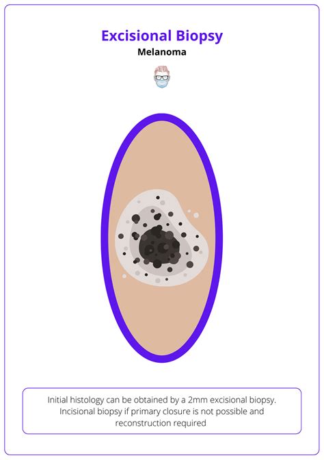 Melanoma: Diagnosis, Features, Sentinel Node, & Staging