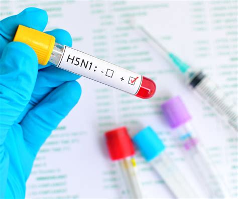 H5N1 Flu: Should We Be Worried? Facts and Precautions