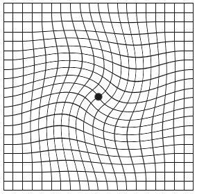 Amsler Grid Examples