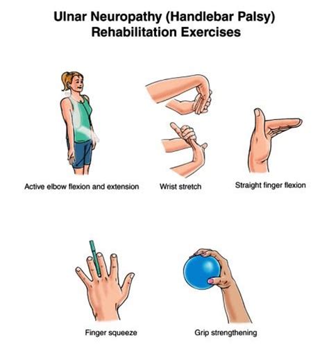 Ulnar Nerve Exercises | EXERCISE FOR ULNAR NERVER INJURY/ULNAR ...