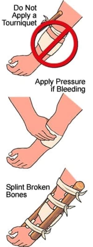 First aid for fractures | Kothari Hospital