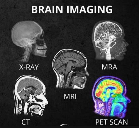 Brain Imaging : r/coolguides