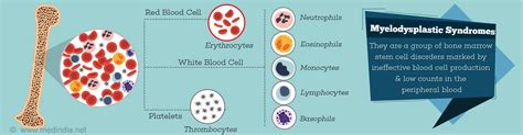 Myelodysplastic Syndrome - Types, Causes, Symptoms, Diagnosis ...