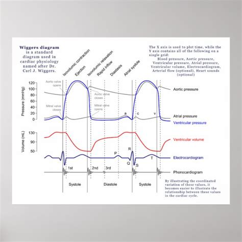 Blank Wiggers Diagram Template