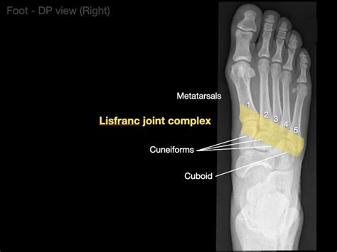 Foot Xray Anatomy