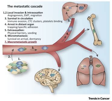 Surviving at a Distance: Organ-Specific Metastasis: Trends in Cancer