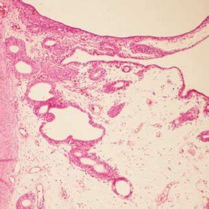 (PDF) Gynaecological Complications Following Improper Ovariohysterectomy in a Dog