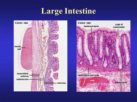 19 best Histology - Large Intestine images on Pinterest | Med school ...