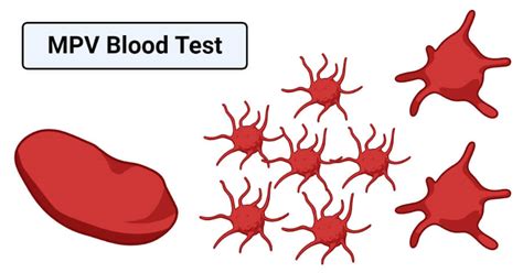 MPV Blood Test- Definition, Calculation, Results, High and Low MPV value