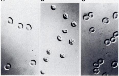 Nomarski interference microscopy. original magnification 900x; current ...