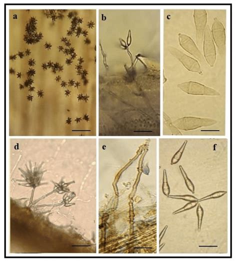 Morphological comparison of the Pyricularia oryzae (a-c) with P. grisea... | Download Scientific ...