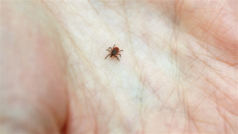 Don't panic if you get bit by a tick. Here are 5 tips to minimize Lyme | Minnesota Public Radio News
