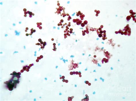 Mycobacterium Marinum Bacteria Photograph by Choksawatdikorn / Science ...