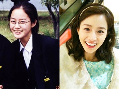 Kim Tae Hee Plastic Surgery Before and After Photos - Star Plastic ...