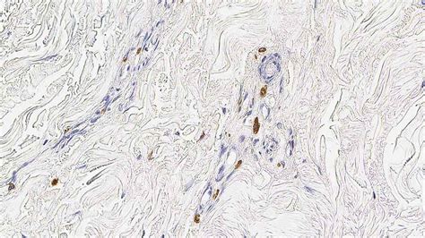 Mast Cell Tryptase - IHC Primary Antibodies