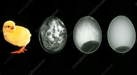 Chicken embryo development - Stock Image P681/0058 - Science Photo Library