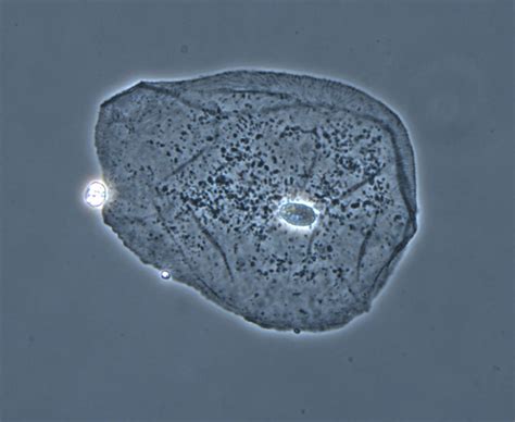 Microscopy Use , Care and Cleaning - Microbiology learning: The "why ...