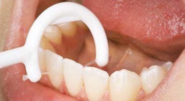 Not a Fan of Flossing? Try These Alternatives. - Dentist in La Mesa, CA