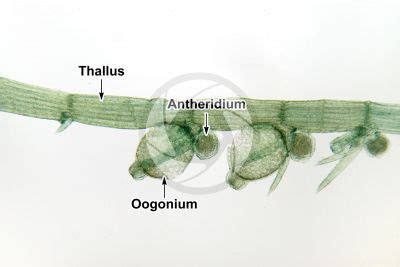 Chara foetida - Charophyta (Green algae) - Algae - Microbiology - Plant histology - Photos