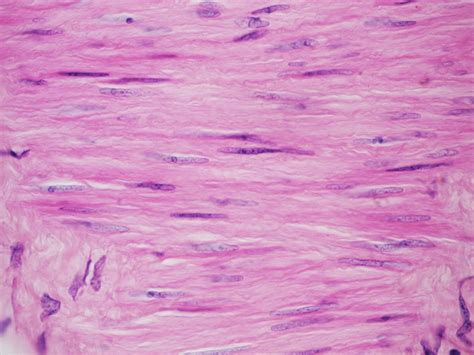 Biologia 1º Bcho CCNN José Ferrándiz Miguel López: Tejido muscular liso