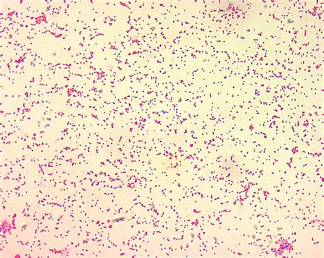 Brucella Suis Gram Stain | My XXX Hot Girl