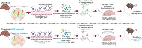 New study finds promising treatment for cognitive deficits associated with cholestatic liver disease