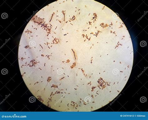 Bacterial Flagellum E.coli Stock Photography - Image: 24741612