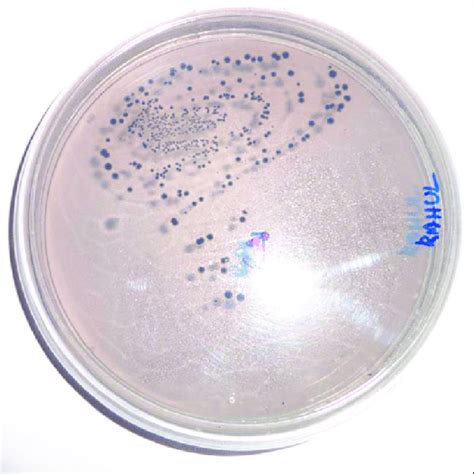 Photograph showing Streptococcus mutans colonies on mitis... | Download ...