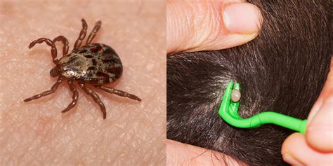 5 Tick Identification And Removal Tips | SELF