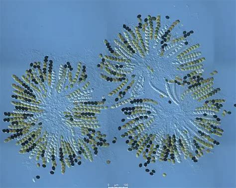 Phylum Ascomycota - Characteristics, Nutrition and Significance