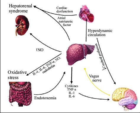 Hepatic Encephalopathy Pathogenesis