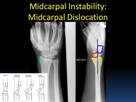 Radiographic MSK Anatomy