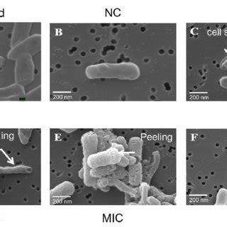 Observation of P. acnes DMST 14916 cell morphology using a scanning ...