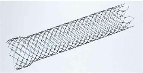 The WallFlex colonic stent (Boston Scientific, Natick, Massachusetts,... | Download Scientific ...