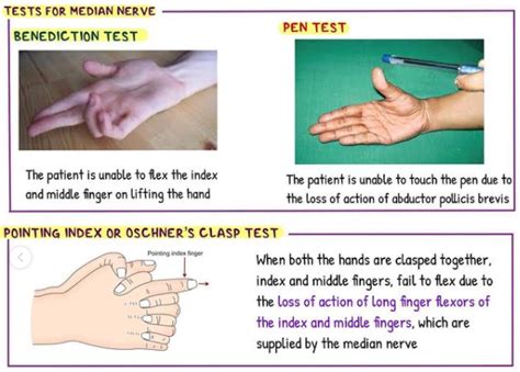 Tests for Median Nerve.