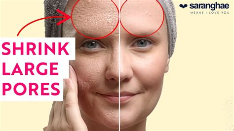 HOW TO SHRINK LARGE PORES - YouTube