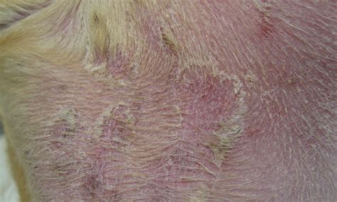 Scaling & Crusting Skin Disease | Clinician's Brief