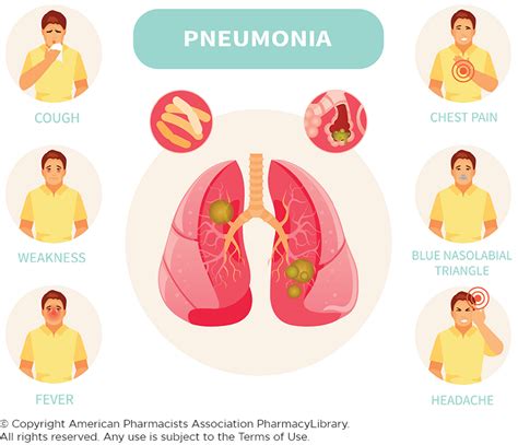 Pneumonia Symptoms | PharmacyLibrary