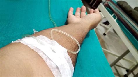 Close up image of IV drip in patient's hand in hospital. | Iv drip ...