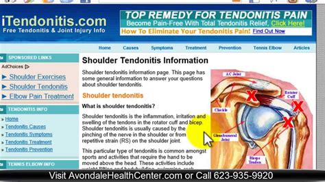 Easy Exercises For Shoulder Tendonitis in Avondale, AZ - YouTube