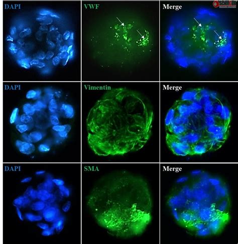 3D Culture of Hepatic Stellate-Endothelial Cell Spheroids, 24-well plate