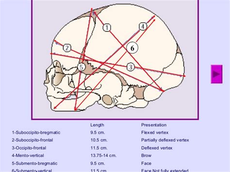 Fetal Skull Dimensions : Mnemonic | Epomedicine