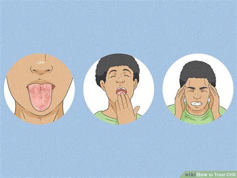 3 Ways to Treat CHS - wikiHow Health