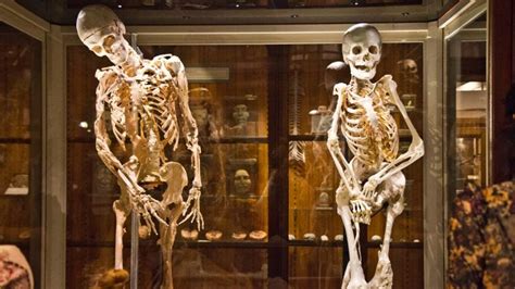 Mütter Museum takes down online exhibits, YouTube videos - WHYY