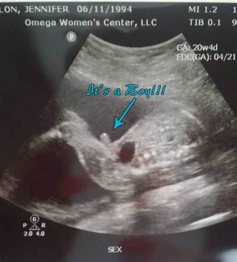 20 week ultrasound. Our Baby Girl is having a Baby Boy!! | Having a baby boy, Boy ultrasound ...