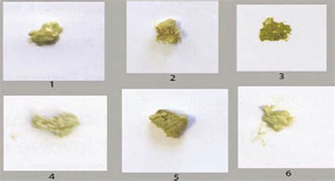 How reliably can paediatric professionals identify pale stool from ...