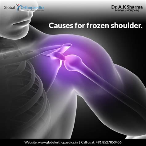 What’s Frozen Shoulder?