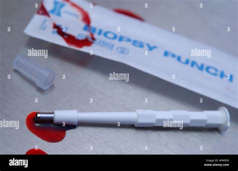 Biopsy Stock Photos & Biopsy Stock Images - Alamy