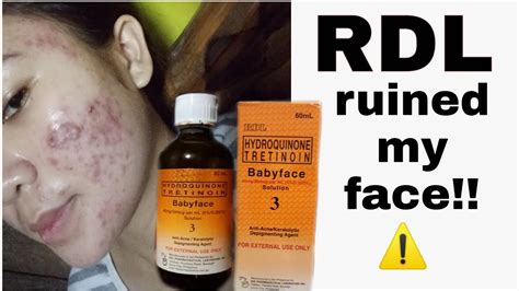 RDL BABYFACE SOLUTION#3 review - YouTube