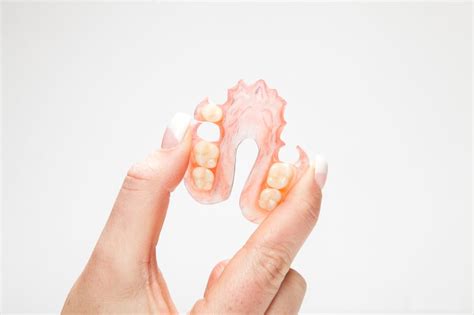 What Are Flexible Partial Dentures? - TORRENS DENTAL CARE